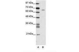 Image no. 1 for anti-Zinc Finger Protein 205 (ZNF205) (AA 31-80) antibody (ABIN202754) (ZNF205 抗体  (AA 31-80))