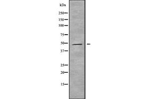 Western blot analysis of MAGAB using HepG2 whole cell lysates (MAGEA11 抗体  (C-Term))