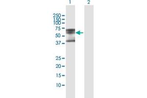 Western Blot analysis of PLA2G3 expression in transfected 293T cell line by PLA2G3 MaxPab polyclonal antibody. (PLA2G3 抗体  (AA 1-509))