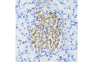 Immunohistochemistry of paraffin-embedded rat pancreatic islet using DLK1 antibody (ABIN3016512, ABIN3016513, ABIN3016514 and ABIN6219768) at dilution of 1:200 (40x lens). (DLK1 抗体)