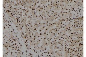 ABIN6272558 at 1/100 staining Human liver tissue by IHC-P. (TFCP2L1 抗体  (N-Term))