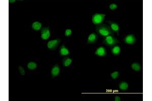 Immunofluorescence of monoclonal antibody to OXSR1 on HeLa cell. (OXSR1 抗体  (AA 1-527))
