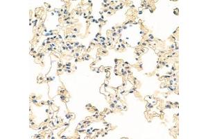 Immunohistochemistry (Paraffin-embedded Sections) (IHC (p)) image for anti-Mal, T Cell Differentiation Protein 2 (MAL2) antibody (ABIN7074549)