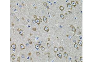 Immunohistochemistry of paraffin-embedded Rat brain using PDE1B Polyclonal Antibody at dilution of 1:100 (40x lens). (PDE1B 抗体)