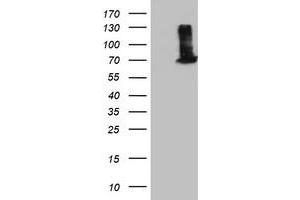 HEK293T cells were transfected with the pCMV6-ENTRY control (Left lane) or pCMV6-ENTRY EPM2AIP1 (Right lane) cDNA for 48 hrs and lysed. (EPM2AIP1 抗体)