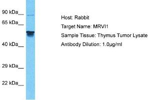 Host: Rabbit Target Name: MRVI1 Sample Tissue: Human Thymus Tumor Antibody Dilution: 1ug/ml