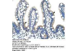 Rabbit Anti-FBL Antibody  Paraffin Embedded Tissue: Human Intestine Cellular Data: Epithelial cells of intestinal villas Antibody Concentration: 4. (Fibrillarin 抗体  (N-Term))