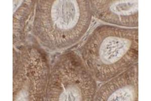 Immunohistochemical analysis of SPINK2 in mouse testis tissue with SPINK2 polyclonal antibody  at 2. (SPINK2 抗体  (C-Term))