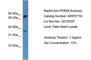 WB Suggested Anti-PDE8A  Antibody Titration: 0. (PDE8A 抗体  (C-Term))