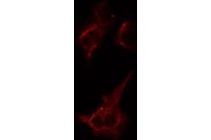 ABIN6274386 staining Hela cells by IF/ICC. (AAK1 抗体  (Internal Region))