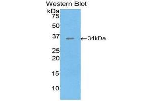 Western Blotting (WB) image for anti-Salt-Inducible Kinase 2 (SIK2) (AA 655-925) antibody (ABIN1860558)