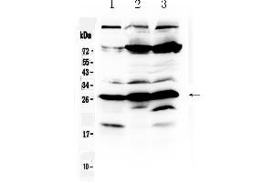 Western blot analysis of RanBP1 using anti- RanBP1 antibody . (RANBP1 抗体  (AA 2-201))