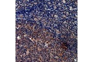Immunohistochemical analysis of Cystatin A staining in human tonsil formalin fixed paraffin embedded tissue section. (CSTA 抗体  (C-Term))