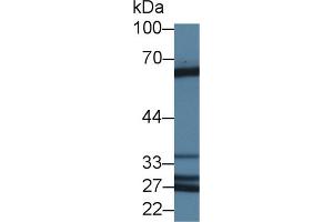 Western Blotting (WB) image for anti-Abl-Interactor 1 (ABI1) (AA 1-182) antibody (ABIN7436735)