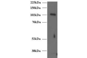 Western Blotting (WB) image for anti-Unc-13 Homolog D (UNC13D) (C-Term) antibody (ABIN2466418) (UNC13D 抗体  (C-Term))