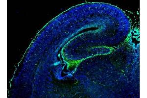 IHC-Fr Image GFAP antibody detects GFAP protein on embryonic mouse brain by immunohistochemical analysis. (GFAP 抗体)