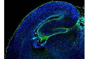 IHC-Fr Image GFAP antibody detects GFAP protein on embryonic mouse brain by immunohistochemical analysis. (GFAP 抗体)