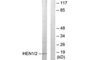Western blot analysis of extracts from Jurkat cells, using HEN1/2 Antibody. (HEN1/2 (AA 41-90) 抗体)