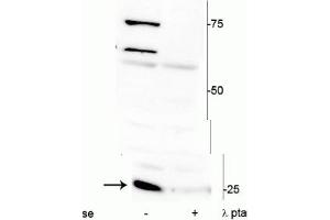 Western blot of mouse heart lysate showing specific immunolabeling of ~25 kDa cardiac troponin I protein phosphorylated at Ser150 in the first lane (-). (TNNI3 抗体  (pSer150))