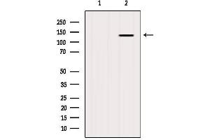 Western blot analysis of extracts from Mouse brain, using GHR Antibody. (Growth Hormone Receptor 抗体  (Internal Region))