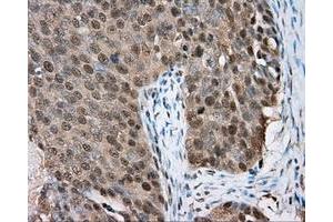 Immunohistochemistry (IHC) image for anti-Bruton Agammaglobulinemia tyrosine Kinase (BTK) antibody (ABIN1496976) (BTK 抗体)