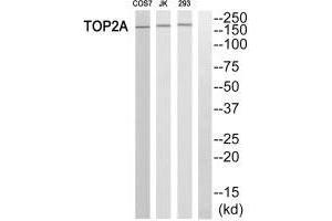 Western blot analysis of extracts from HT-29 cells, using TOP2A antibody. (Topoisomerase II alpha 抗体  (N-Term))