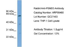 WB Suggested Anti-PSMD3  Antibody Titration: 0. (PSMD3 抗体  (Middle Region))