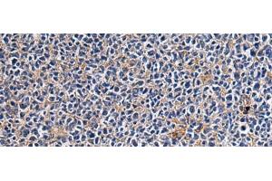 Immunohistochemistry of paraffin-embedded Human tonsil tissue using CEP89 Polyclonal Antibody at dilution of 1:95(x200) (CEP89 抗体)