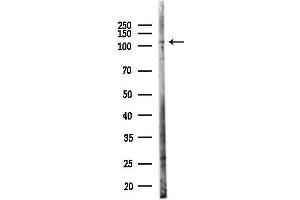 Western blot analysis of lysates from PC12 cells(UV,30 min treatment), using BMPR2 Antibody at 1/1000 dilution.