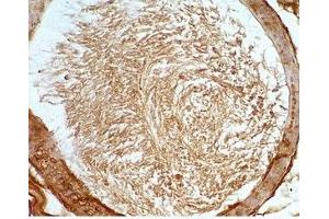 Mouse testis tissue was stained by Rabbit Anti-Desnutrin (465-486) (Mouse) Serum (PNPLA2 抗体  (AA 465-486))