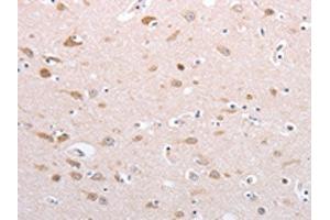The image on the left is immunohistochemistry of paraffin-embedded Human brain tissue using ABIN7130592(PFN4 Antibody) at dilution 1/20, on the right is treated with fusion protein. (Profilin 4 抗体)