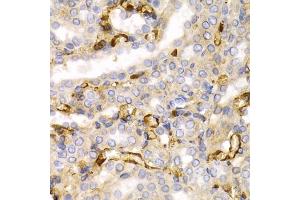 Immunohistochemistry (IHC) image for anti-Neurofilament, Light Polypeptide (NEFL) (AA 400-543) antibody (ABIN3020809)