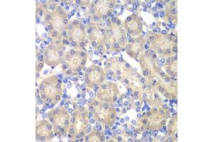 Immunohistochemistry of paraffin-embedded rat kidney using  antibody (ABIN6127428, ABIN6136509, ABIN6136511 and ABIN6217463) at dilution of 1:100 (40x lens). (Aminoacylase 1 抗体  (AA 1-408))