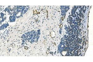 IHC analysis of H Cadherin/CDH13 using anti-H Cadherin/CDH13 antibody (ABIN7600095). (Cadherin 13 抗体  (AA 149-692))