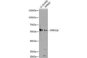 Western blot analysis of extracts of various cell lines using PTPN18 Polyclonal Antibody at dilution of 1:1000. (PTPN18 抗体)
