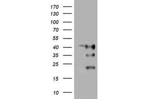 Image no. 1 for anti-Transmembrane Protein 173 (TMEM173) antibody (ABIN1501423) (STING/TMEM173 抗体)