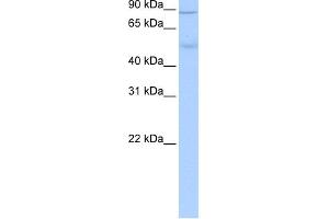 WB Suggested Anti-ALDH1L1 Antibody Titration: 0. (ALDH1L1 抗体  (Middle Region))