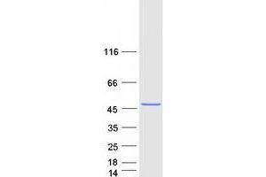 Western Blotting (WB) image for Snurportin 1 (SNUPN) (Transcript Variant 1) protein (Myc-DYKDDDDK Tag) (ABIN2732326)