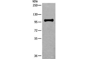 Western blot analysis of HEPG2 cell lysate using HELLS Polyclonal Antibody at dilution of 1:400 (HELLS 抗体)