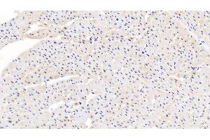 Immunohistochemistry (IHC) image for anti-Calreticulin (CALR) (AA 196-310) antibody (ABIN7438052)