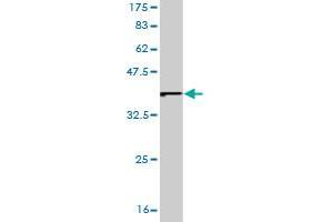 Western Blot detection against Immunogen (37. (EIF2A 抗体  (AA 1-100))