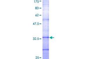 Image no. 1 for Somatostatin Receptor 2 (SSTR2) (AA 1-60) protein (GST tag) (ABIN1321439)