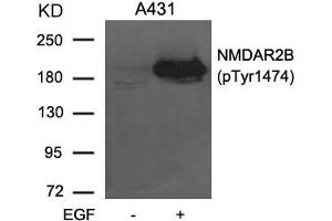 Western blot analysis of extracts from A431 cells untreated or treated with EGF using NMDAR2B (phospho-Tyr1474) Antibody. (GRIN2B 抗体  (pTyr1474))