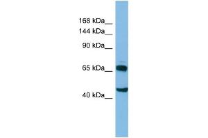 Host: Rabbit Target Name: CLASP2 Sample Type: HT1080 Whole cell lysates Antibody Dilution: 1. (CLASP2 抗体  (C-Term))