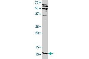 S100A16 polyclonal antibody .