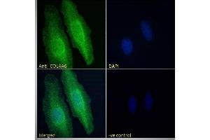 ABIN570771 Immunofluorescence analysis of paraformaldehyde fixed HeLa cells, permeabilized with 0.