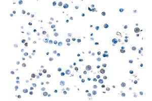 Immunocytochemistry (ICC) image for anti-Transforming Growth Factor, beta 1 (TGFB1) (AA 325-375) antibody (ABIN7449529) (Recombinant TGFB1 抗体  (AA 325-375))