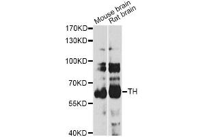 Western blot analysis of extracts of various cell lines, using TH antibody (ABIN5974878) at 1/1000 dilution. (TH 抗体)