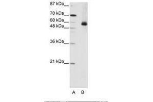 Image no. 2 for anti-Heterogeneous Nuclear Ribonucleoprotein L (HNRNPL) (AA 281-330) antibody (ABIN203218) (HNRNPL 抗体  (AA 281-330))
