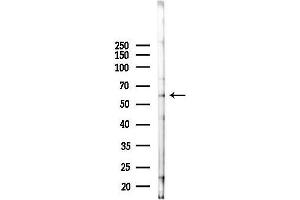 anti-Ectonucleoside Triphosphate diphosphohydrolase 6 (ENTPD6) antibody